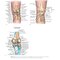 Noyes’ Knee Disorders: Surgery, Rehabilitation, Clinical Outcomes, 2nd Edition 2016