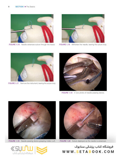 Gartsman’s Shoulder Arthroscopy 3rd Edition2018
