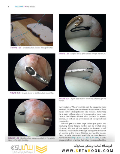 Gartsman’s Shoulder Arthroscopy 3rd Edition2018