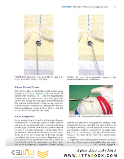 Gartsman’s Shoulder Arthroscopy 3rd Edition2018