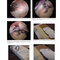 Gartsman’s Shoulder Arthroscopy 3rd Edition2018