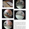 Gartsman’s Shoulder Arthroscopy 3rd Edition2018