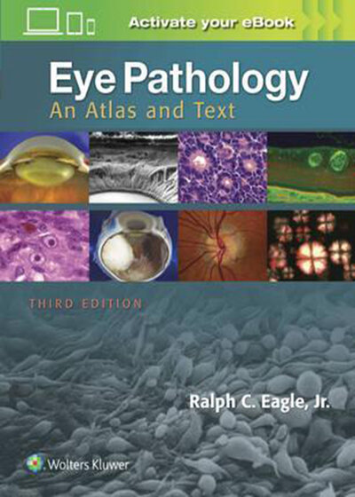 Eye Pathology, 3th Edition2016 آسیب شناسی چشم