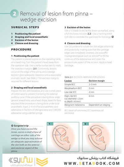 ENT and Head and Neck Procedures: An Operative Guide 2014