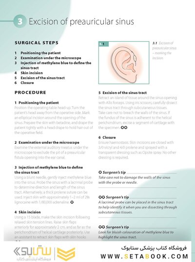 ENT and Head and Neck Procedures: An Operative Guide 2014
