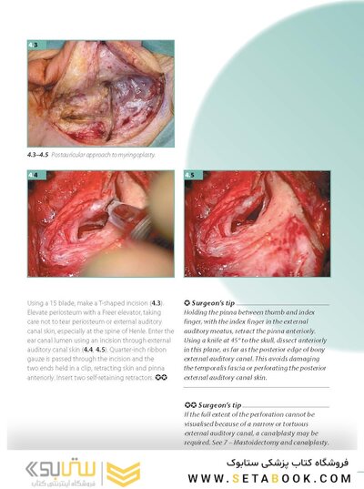 ENT and Head and Neck Procedures: An Operative Guide 2014