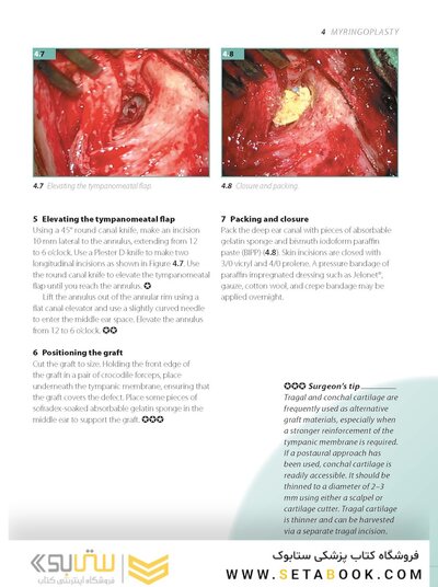 ENT and Head and Neck Procedures: An Operative Guide 2014
