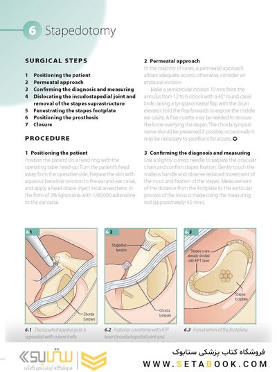 ENT and Head and Neck Procedures: An Operative Guide 2014