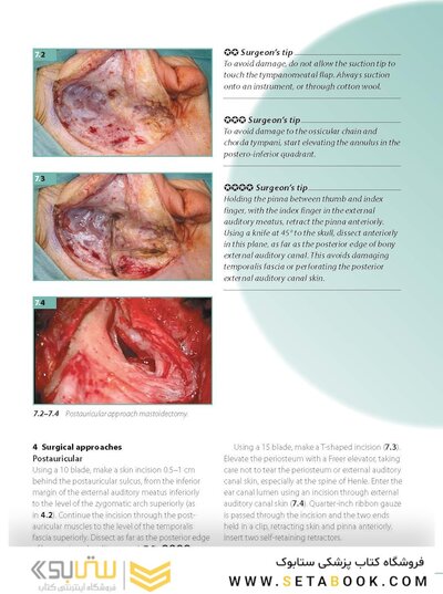 ENT and Head and Neck Procedures: An Operative Guide 2014