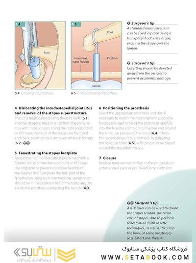 ENT and Head and Neck Procedures: An Operative Guide 2014