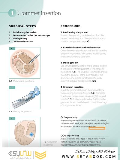 ENT and Head and Neck Procedures: An Operative Guide 2014