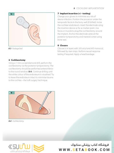 ENT and Head and Neck Procedures: An Operative Guide 2014