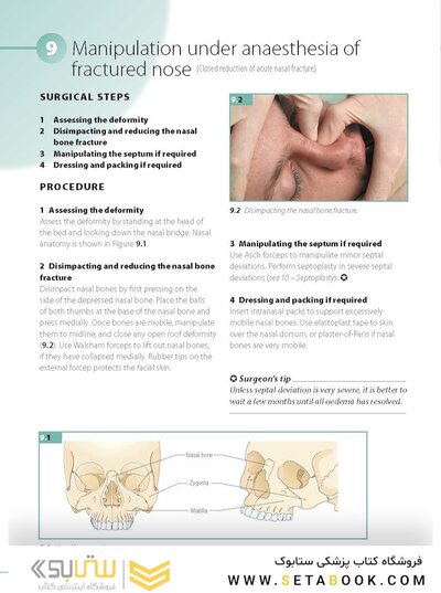 ENT and Head and Neck Procedures: An Operative Guide 2014