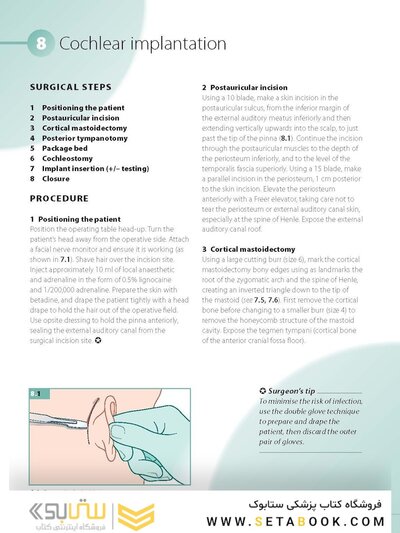 ENT and Head and Neck Procedures: An Operative Guide 2014