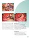 ENT and Head and Neck Procedures: An Operative Guide 2014