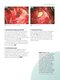 ENT and Head and Neck Procedures: An Operative Guide 2014