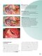 ENT and Head and Neck Procedures: An Operative Guide 2014