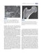 Basic Biomechanics of the Musculoskeletal System, Fourth Edition 2012