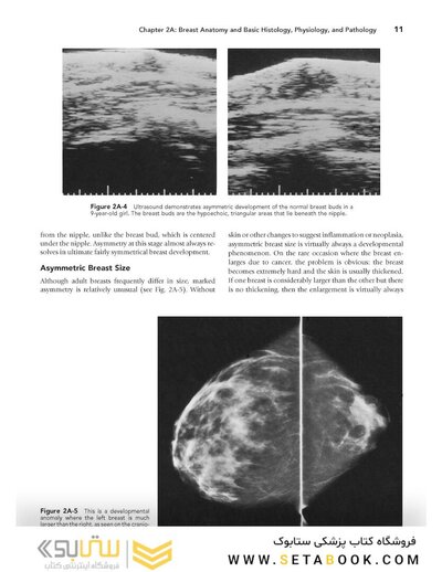 Breast Imaging (Kopans, Breast Imaging) Third Edition2006