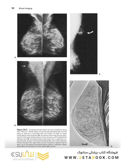 Breast Imaging (Kopans, Breast Imaging) Third Edition2006