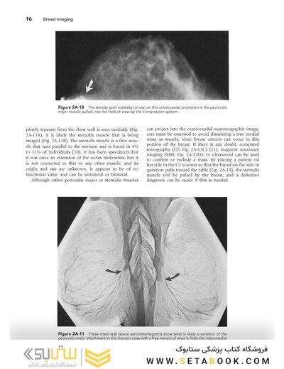 Breast Imaging (Kopans, Breast Imaging) Third Edition2006