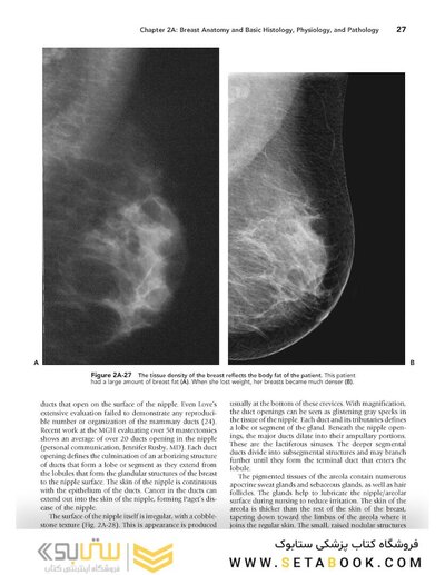 Breast Imaging (Kopans, Breast Imaging) Third Edition2006