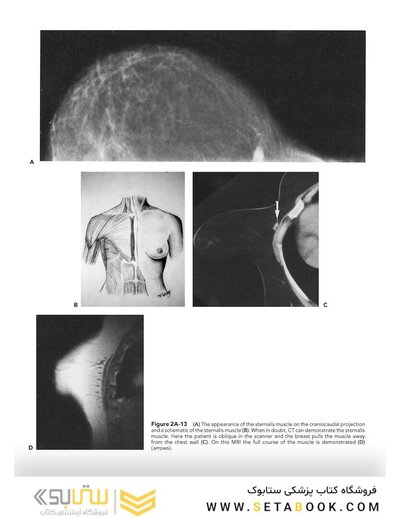 Breast Imaging (Kopans, Breast Imaging) Third Edition2006