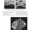 Breast Imaging (Kopans, Breast Imaging) Third Edition2006