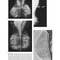 Breast Imaging (Kopans, Breast Imaging) Third Edition2006