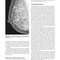 Breast Imaging (Kopans, Breast Imaging) Third Edition2006