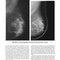Breast Imaging (Kopans, Breast Imaging) Third Edition2006