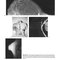 Breast Imaging (Kopans, Breast Imaging) Third Edition2006