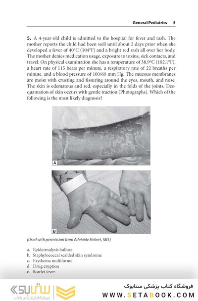 Pediatrics PreTest Self-Assessment And Review 15th Edition2020