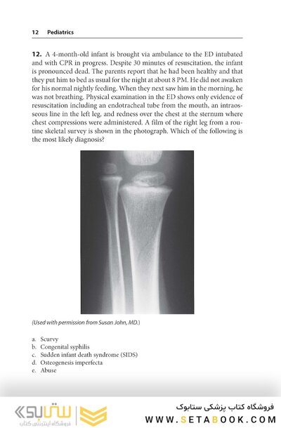 Pediatrics PreTest Self-Assessment And Review 15th Edition2020