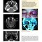 The Eye: Basic Sciences in Practice 4th Edition2015