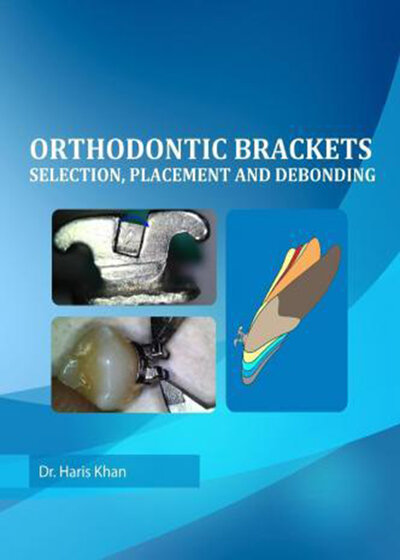 Orthodontic Brackets: Selection,Placement and Debonding2015 براکت های ارتودنسی: انتخاب ، جاگذاری و رد کردن