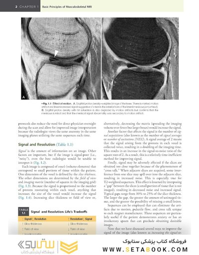 Musculoskeletal MRI 3rd Edition2019