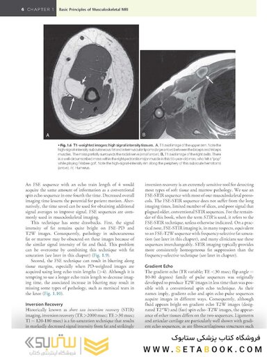 Musculoskeletal MRI 3rd Edition2019