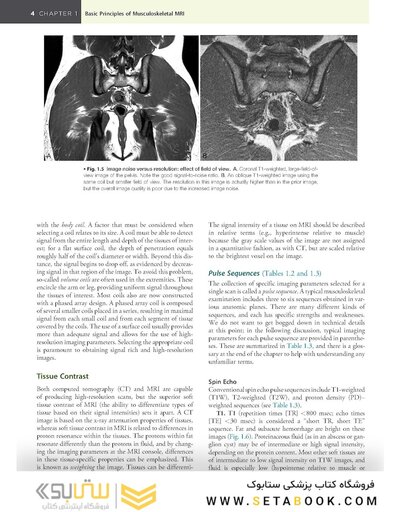 Musculoskeletal MRI 3rd Edition2019