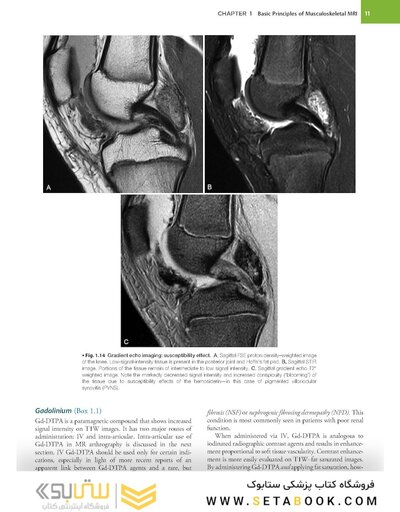 Musculoskeletal MRI 3rd Edition2019