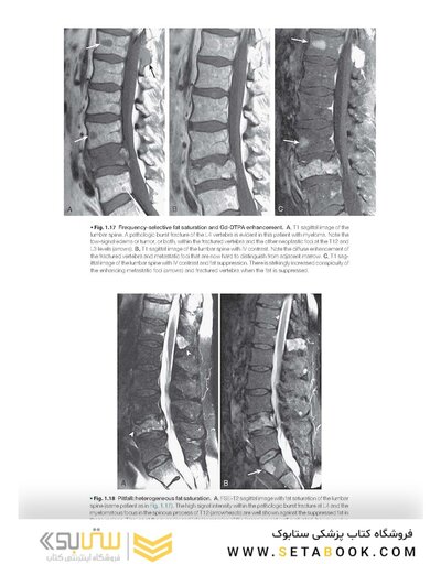 Musculoskeletal MRI 3rd Edition2019
