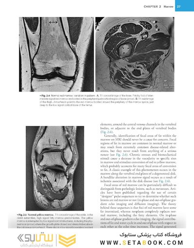 Musculoskeletal MRI 3rd Edition2019