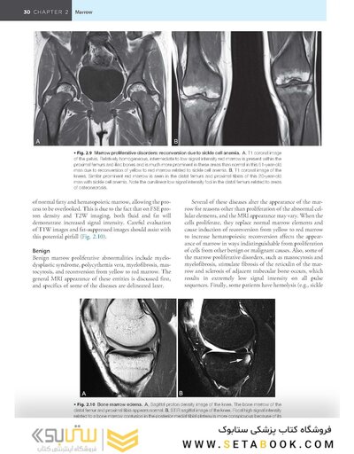 Musculoskeletal MRI 3rd Edition2019