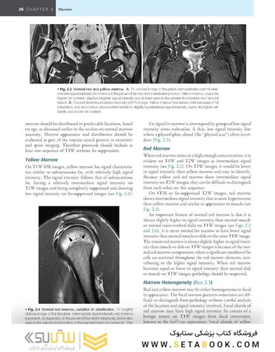 Musculoskeletal MRI 3rd Edition2019