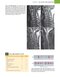 Musculoskeletal MRI 3rd Edition2019