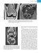 Musculoskeletal MRI 3rd Edition2019