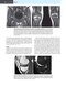 Musculoskeletal MRI 3rd Edition2019