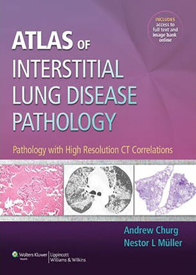 Atlas of Interstitial Lung Disease Pathology 2014