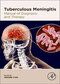 Tuberculous-Meningitis2020 مننژیت سل