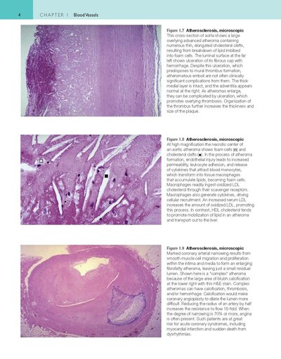 Robbins and Cotran Atlas of Pathology (Robbins Pathology) 4th Edition